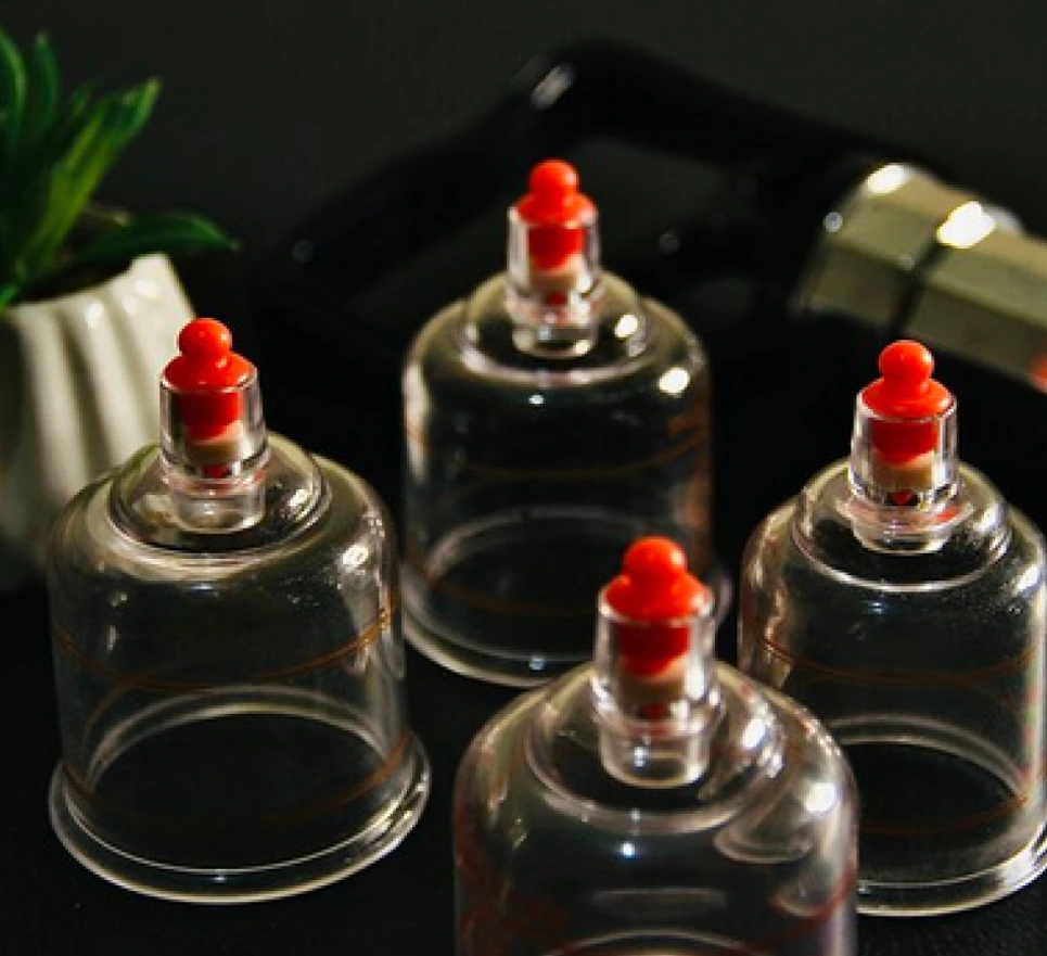 Cupping Therapy